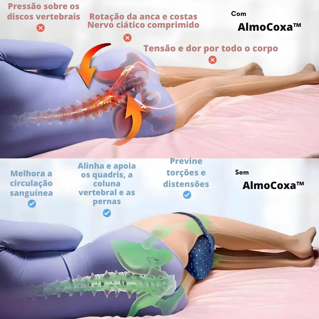 AlmoCoxa™️ - Alivia os quadris, as costas e a ciática